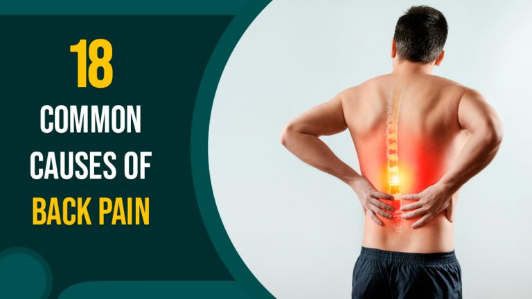18 Common Causes of Back Pain