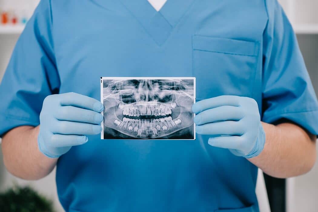 14 Things to Know about Invisalign Treatment - Dental Clinic London