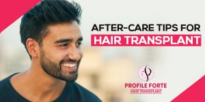 After-care-tips-for-hair-transplant