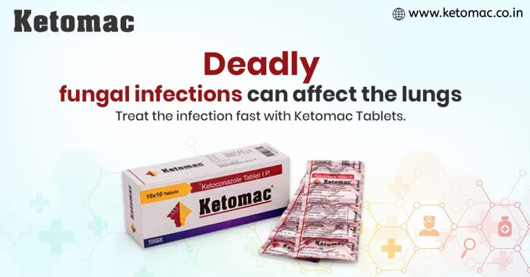 Ketomac tablet serves as the best antifungal treatment