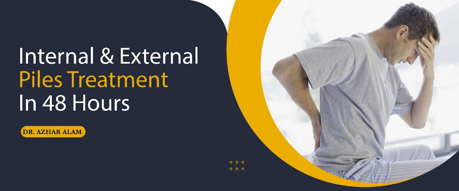 Internal & External Piles Treatment In 48 Hours Home
