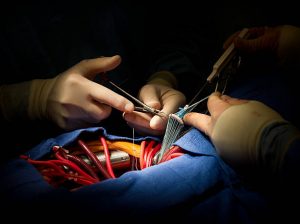 surgeon performing valve surgery