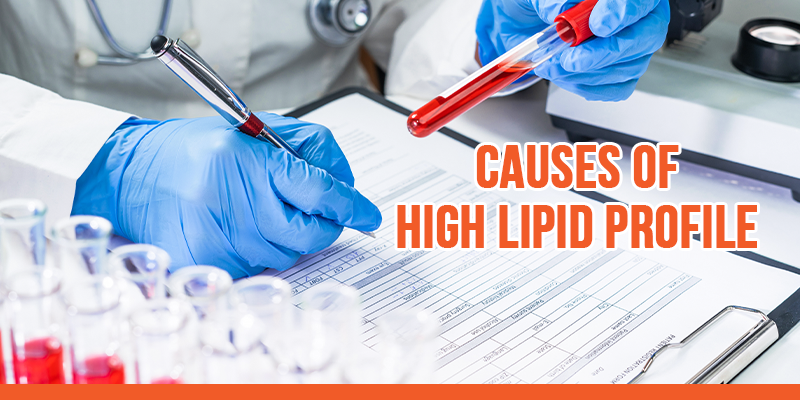 Causes of High Lipid Profile
