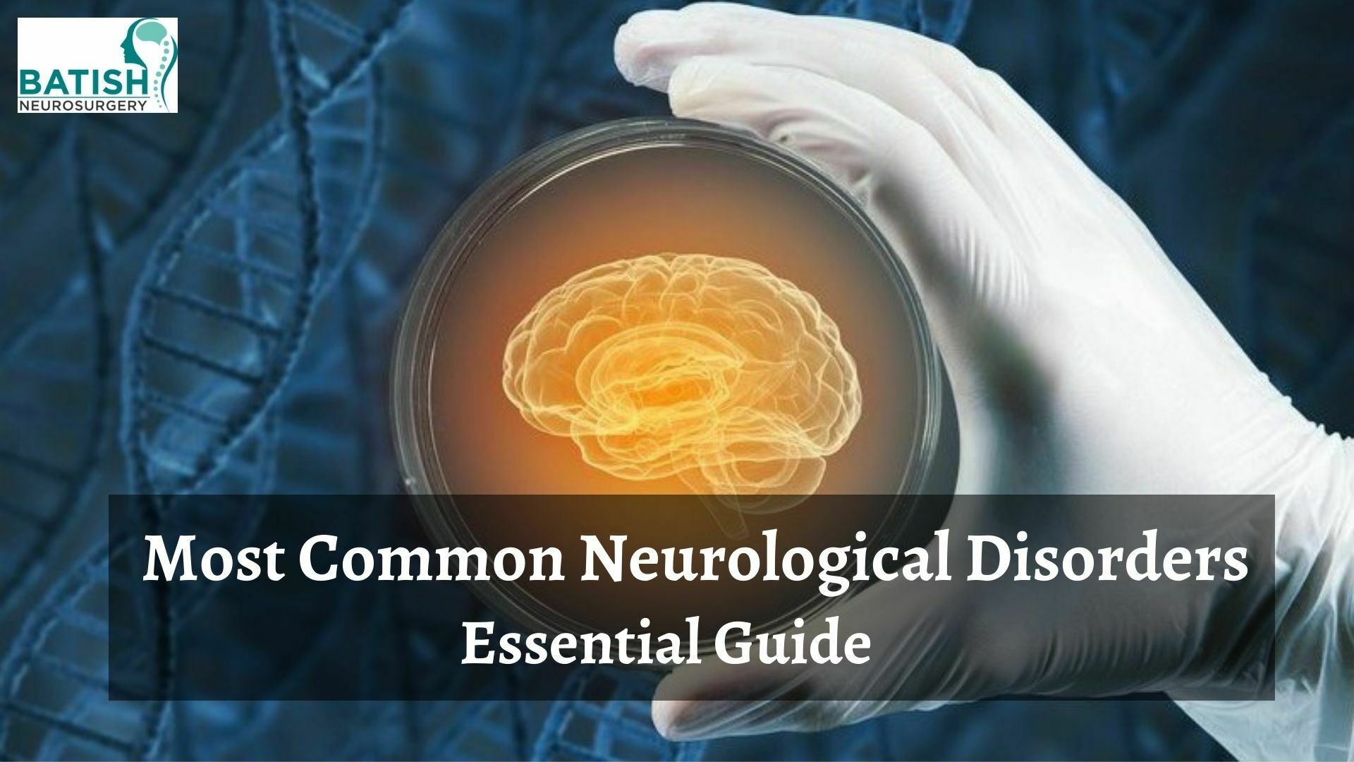 Most Common Neurological Disorders: Essential Guide