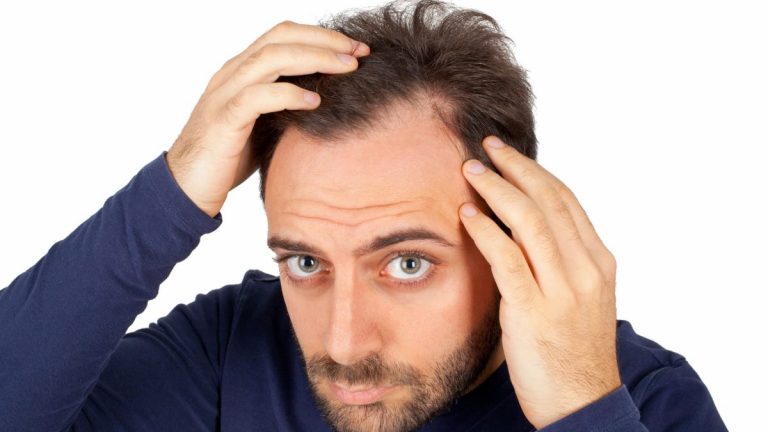 Recommended Haircuts for Men with Receding Hairline